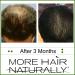 More Hair Naturally 9 - Advanced Stem Cell Therapy for Thinning Hair - Buy Online on SooperMarket.com