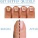 Nail Growth and Repair Serum Nail Strengthening and Growth Conditioner Nourish Strengthen And Revitalize Your Nails (1 Pcs) - Buy Online on SooperMarket.com