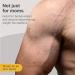 Stretch Marks Removal Cream | Safe for Pregnancy | Dermatologically Tested | All Skin Types | 100g - Buy Online on SooperMarket.com