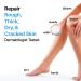 Urea Cream 40 with Salicylic Acid 4.6 Oz - Intensive Callus Remover for Dry Cracked Feet & Hands - Moisturizing & Exfoliating Foot Cream - 4.6 Ounce (Pack of 1) - Buy Online on SooperMarket.com