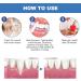 Fengyang 2PCs Gum Gel - Instant Gum Therapy & Restoration Gel for Healthy Gums | International Shipping Available - Buy Online on SooperMarket.com