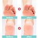 TBeautfave Urea Foot Cream 40% Urea Cream Callus Remover For Dry And Hard Skin Cracked Heel Repair Cream Deep Moisturizing Feet Cream Nourishes Soften for Feet Elbows Knees - Buy Online on SooperMarket.com