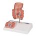 3B Scientific K27 Hemorrhoid Model 5.5-Inchx3.9-Inchx5.5-Inch - Buy Online on SooperMarket.com