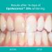 Opalescence 35% Teeth Whitening Gel Syringes - 4 Pack Mint Flavor - Buy Online on SooperMarket.com