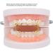 Hip Hop Brace Party Teeth Brace Compatible for Halloween for Party for Music Concerts(Gold) - Buy Online on SooperMarket.com