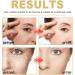 Dajidafu Women Face Wrinkle Remover Ladies Moisturizing Brightening Anti-wrinkle Essence Dark Spot Removal Skin Care 30ml - Buy Online on SooperMarket.com