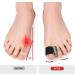 Bunion Corrector Toe Separators for Men - Flexible Relief and Prevention - Buy Online on SooperMarket.com