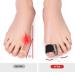 Flexible Bunion Relief Toe Separators - 6 Pairs for Women | Prevent Friction and Correct Bunions | Hard Wearing Toe Spacers - Buy Online on SooperMarket.com
