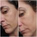 Dark Spot Corrector & Brightening Serum with Kojic Acid, Vitamin C, Salicylic Acid & More | Melasma Treatment Cream by Admire My Skin - Buy Online on SooperMarket.com