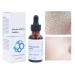 Luxsea Salicylic Acid 2% Serum for Clearer Skin - Shrinks Pores, Treats Rosacea, Blackheads, and Acne - Gentle Exfoliating Hyaluronic Acid Formula - Buy Online on SooperMarket.com