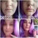 Lip Plumper Portable Size Fish-Shaped Lip Plumper Enhancer Improving Lip Drooping Lip Plumper Suction Full Lips Suction Silicone Material for Women Makeup - Buy Online on SooperMarket.com