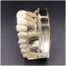 Implant Tooth Template | Oral Simulation Dental Study Model for Teaching - Shop Internationally - Buy Online on SooperMarket.com