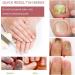 Okita Toenail Fungus Treatment Pen - Effective Nail Repair for Healthy and Strong Nails (5Pcs) - Buy Online on SooperMarket.com