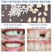 ChezMax Temporary Tooth Repair Kit - Fix Missing & Broken Teeth - Natural Solution - Buy Online on SooperMarket.com