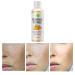 Toner for Dark Spots Turmeric Dark Spot Corrector Toner  Facial Toner for Acne Prone Skin  Dark Spot Remover for Face Hydrating Face Toner for Women  Hyperpigmentation Treatment for Dry Oily Skin 4OZ