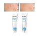 Anshka Organic Scar Removing Gel Keloid Scar Removal Cream for Surgical Scars Old Scar for Lightening Scars and Acne Marks Suitable for Sensitive Skin (2pcs)