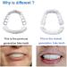 4-Piece Snap-In Veneers - Comfort Fit Fake Teeth for Perfect Smile | Beautiful Dentures for Broken Teeth - Buy Online on SooperMarket.com