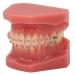 Orthodontic Demonstration Model for Dental Research | Metal Wires & Ceramic Brackets | Teaching Aids for Adults - Buy Internationally - Buy Online on SooperMarket.com