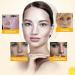 Dark Spot Remover Cream for Face, Body & Sensitive Areas - With Alpha Arbutin, Niacinamide, Collagen, Vitamin E - Powerful Age Spot Corrector - Buy Online on SooperMarket.com