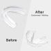 BBTO 20 Pieces Sports Mouth Guards - Transparent Athletic Mouth Guard for Kids and Adults - Buy Online on SooperMarket.com