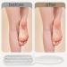 Foot File Foot Scraper for Hard Skin Professional Pedicure Double Side Foot Files Callus Remover Foot Scrubber Metal Foot Rasp Foot Care Tool for Dead Skin Cracked Heels Corn Removal - Buy Online on SooperMarket.com