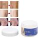 50g Natural Varicose Veins Cream | Leg Circulation & Spider Vein Remover | Cooling Effect | Ointment - Buy Online on SooperMarket.com