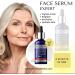 Lorenti 4-in-1 Face Serum 50 ml | Reduces Skin Imperfections Tightens Skin Brightens Revitalizes and Hydrates Skin - Contains Vitamin C - For All Skin Types 1.7 Fl Oz - Buy Online on SooperMarket.com