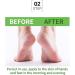 42% Urea Foot Cream - Urea Cream for Feet - Foot Cream for Dry Cracked Heels and Feet - Urea Cream with Salicylic Acid 2% Tea Tree Aloe Vera - Foot Lotion for Deep Moisturize for Thick Rough Skin - Buy Online on SooperMarket.com
