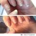 Buy IBX Mini Duo Pack Nail Polish | FREE Dadi Oil | Restore & Protect Your Nails Internationally - Buy Online on SooperMarket.com
