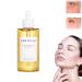 Centella Asiatica Face Serum Centella Serum for Face Recovery Face Serum for Acne Pore Skin Sensitive Oily Dry Skin Soothing Hydrating Serum for Women 100ml