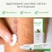 Kelosoft - Natural Scar Removal Cream Keloid Scar Removal Gel Plant Based Herbal Scar Cream Helps Reduce Visibility of Scars - 25g - Buy Online on SooperMarket.com