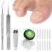 (12 +3) Ingrown Toenail Correction Treatment Kit Toenail Straightener Strips Recover Clips Plastics Ingrown Toenail Correction Strips Brace Kit for Women Men Ingrown Thick Nail