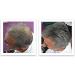 Caboki Hair Loss Concealer Hair Building Fiber 25g (Black) - Buy Online on SooperMarket.com