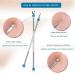 Ellolife 4-Pack Comedone Squeezer Set | Stainless Steel Blackhead Remover Kit for All Skin Types - Buy Online on SooperMarket.com