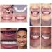 5 Pieces Snap-In Veneers Teeth - Comfortable Flexible Dentures for a Beautiful Smile - Buy Online on SooperMarket.com