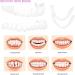 4 Pcs Fake Teeth Dentures for Women and Men - Temporary Dental Veneers for Natural, Comfortable Teeth Restoration, Protecting Your Smile - Buy Online on SooperMarket.com