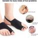 Bunionette Sleeve for Waiters & Retail Workers - Eliminate Soreness, Soft & Stretchy Bunion Corrector (Size L) - Buy Online on SooperMarket.com