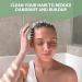 Sndyi Scalp Massager Shampoo Brush - Dandruff Removal & Hair Growth - Silicone Scrubber for Shower - Green - Buy Online on SooperMarket.com