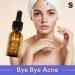 SKIN LABO SkinLabo Active Serum Aha + Bha Eliminates Surface Dead Cells Skin Perfecter with Exfoliating and Purifying Action 15 ml (Old Version) - Buy Online on SooperMarket.com