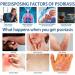 Eczema & Psoriasis Cream - Natural Relief for Dry, Itchy Skin | Scalp Rash Redness Acne - Buy Online on SooperMarket.com