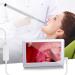 Marycan 3.9mm HD Ear Wax Removal Otoscope with 6 LED Lights - 4.3 Inch Screen Endoscope Ear Tip for Children and Adults - Buy Online on SooperMarket.com