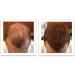 Caboki Hair Loss Concealer Hair Building Fiber 25g (Black) - Buy Online on SooperMarket.com