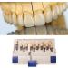 29 Color Porcelain Tooth Whitening Color Keys - Removable Tooth Elevation Table for Accurate Shade Matching - Buy Online on SooperMarket.com