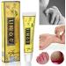 6PCS Chinese Herbal Eczema Psoriasis Creams for Dermatitis & Pruritus - CEZUBEM Ointment - Buy Online on SooperMarket.com