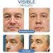 CHUANGJIA OPENEYES Peptide Lifting Eye Gel Set - Reduce Bags, Wrinkles, Dark Circles - 3PCS - Buy Online on SooperMarket.com