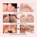 Feet Foot Repairing Cream - Moisturizing Balm for Dry Cracked Heels | 15g/0.53oz - Best Remedy for Dry Feet - Buy Online on SooperMarket.com