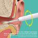 Plbrez NE6 WiFi HD Earpick - 360-Degree Cross-Border Ear Scoop for International Shipping - Buy Online on SooperMarket.com