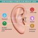 3Pairs Reetuzz Acupuncture Earring Acupressure Slimming Earrings Non Piercing Acupressure Earrings for Weight Loss (3 Pairs) - Buy Online on SooperMarket.com