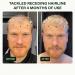 Scandinavian Biolabs Hair Growth System for Men | Clinically Proven Hair Loss Treatment in 45 Days - Buy Online on SooperMarket.com
