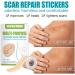 Silicone Scar Gel Strip - Efficient Scar Treatment for Surgery, Acne & Trauma - 4 * 150cm - Buy Online on SooperMarket.com